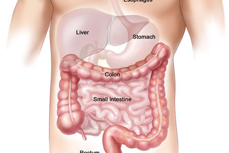 Sleeve Gastrectomy vs. Lap Band